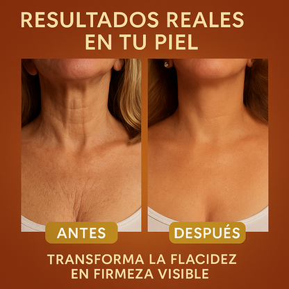 MagicBody™️ | Chau Piel Suelta!, Sin Clínicas Ni Agujas